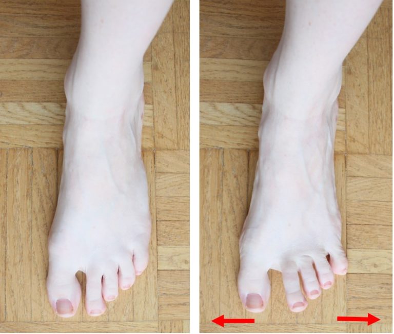 Fersensporn / Plantarfasziitis: Aktivierung Fußmuskulatur
