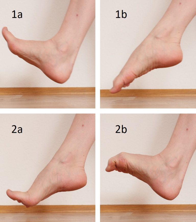 Fersensporn / Plantarfasziitis: Aktivierung Zehenflexion Extension kombiniert