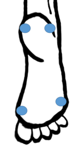 Fersensporn / Plantarfasziitis: Fußstabilisation schematisch