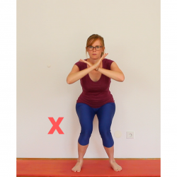 Patellaspitzensyndrom_Kniebeuge_Valgus Patellaspitzensyndrom: KniebeugeValgus